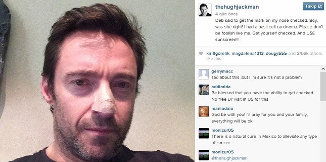 Hugh Jackman'nın Kanser Açıklaması