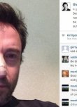 Hugh Jackman'nın Kanser Açıklaması