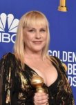 Patricia Arquette Severance Kadrosuna Dahil Oldu!