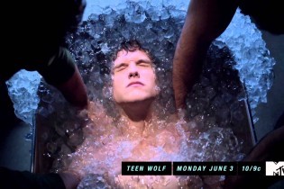 Teen Wolf Fotoğrafı
