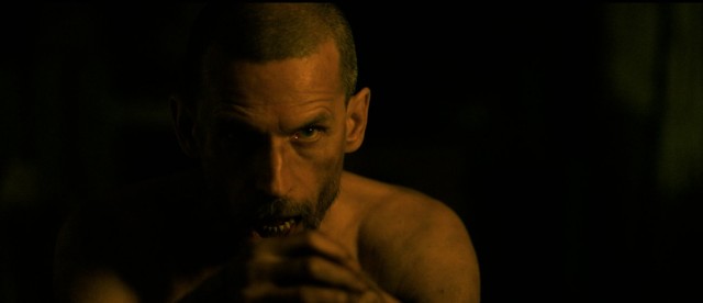 Septic Man Fotoğrafı