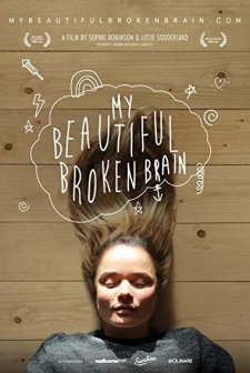 My Beautiful Broken Brain (2014) afişi