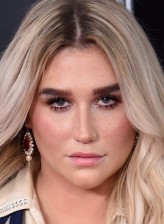 Kesha fotoğrafı