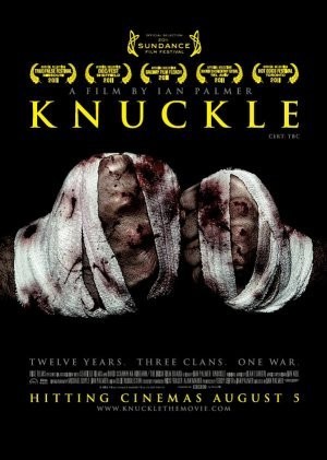 Knuckle Fotoğrafı