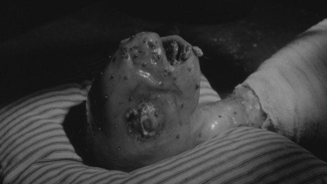 Eraserhead Fotoğrafı