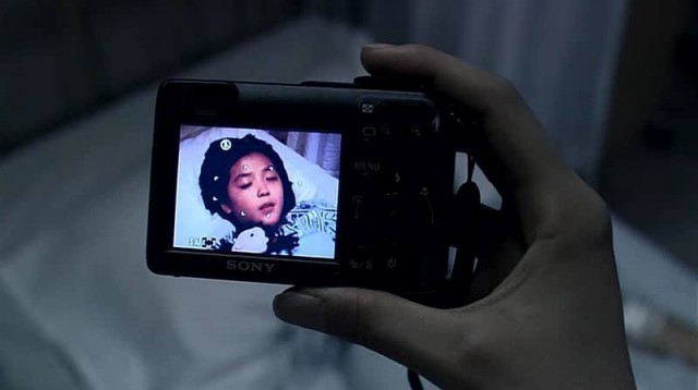 Coma fotoğrafı