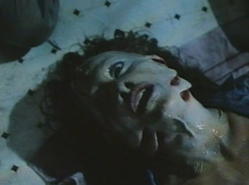 Kan Bağı Fotoğrafı